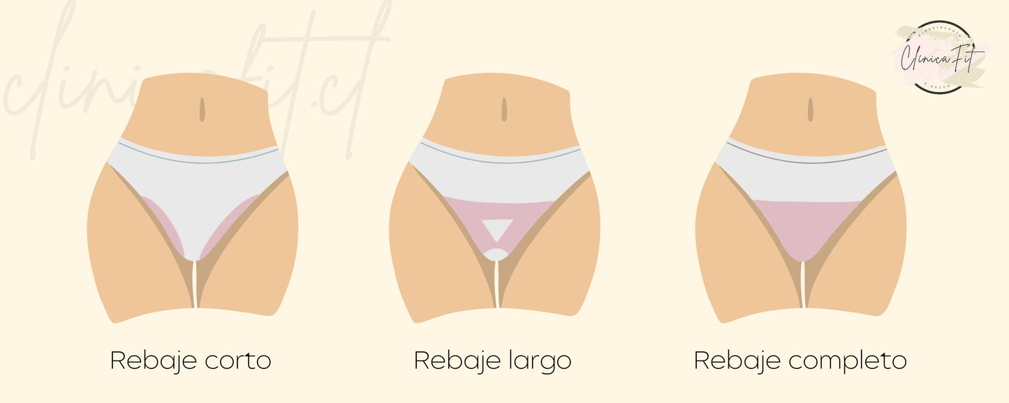 Depilación láser: Rebaje completo (6 sesiones)
