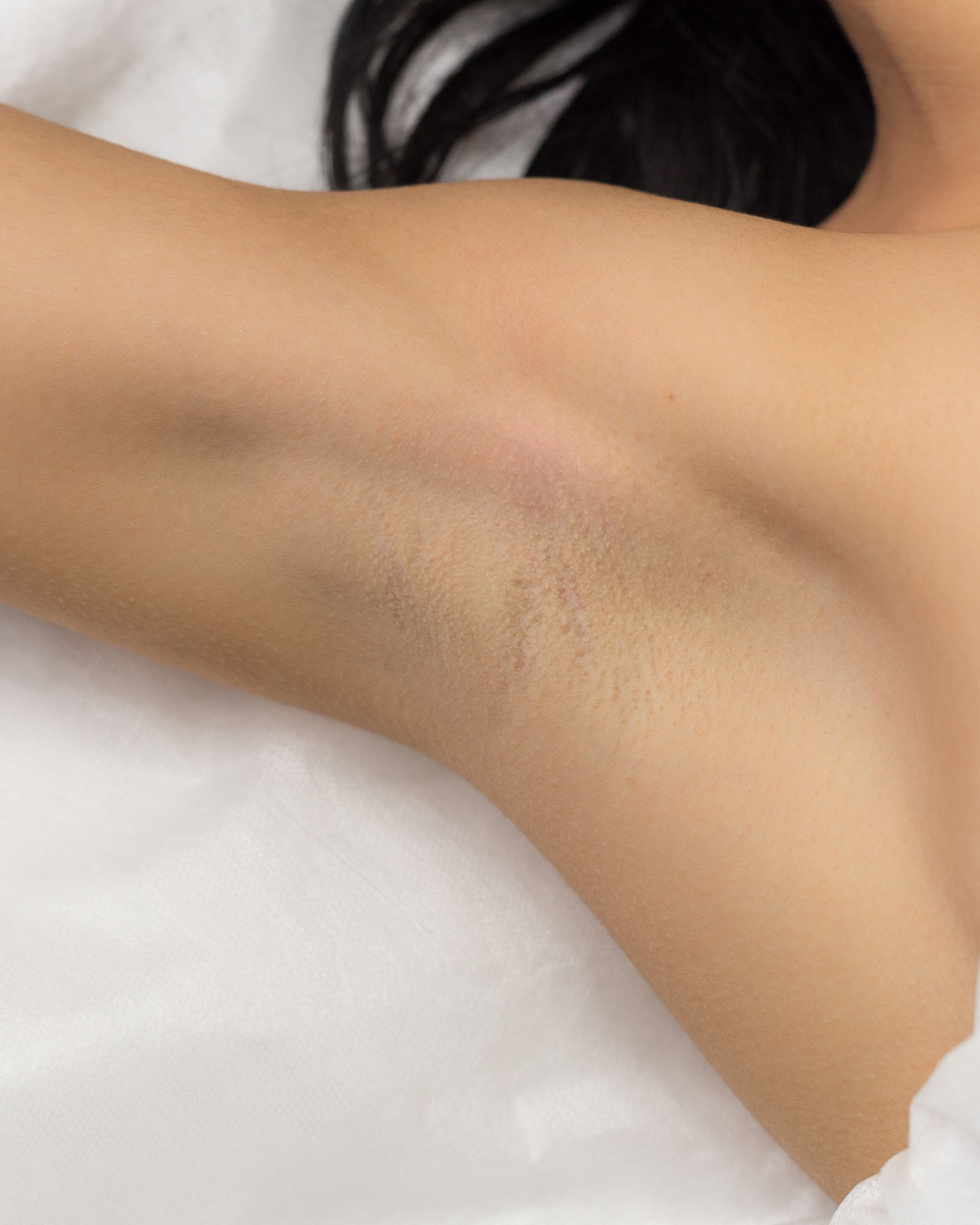 Despigmentante Axilas - Pack 1