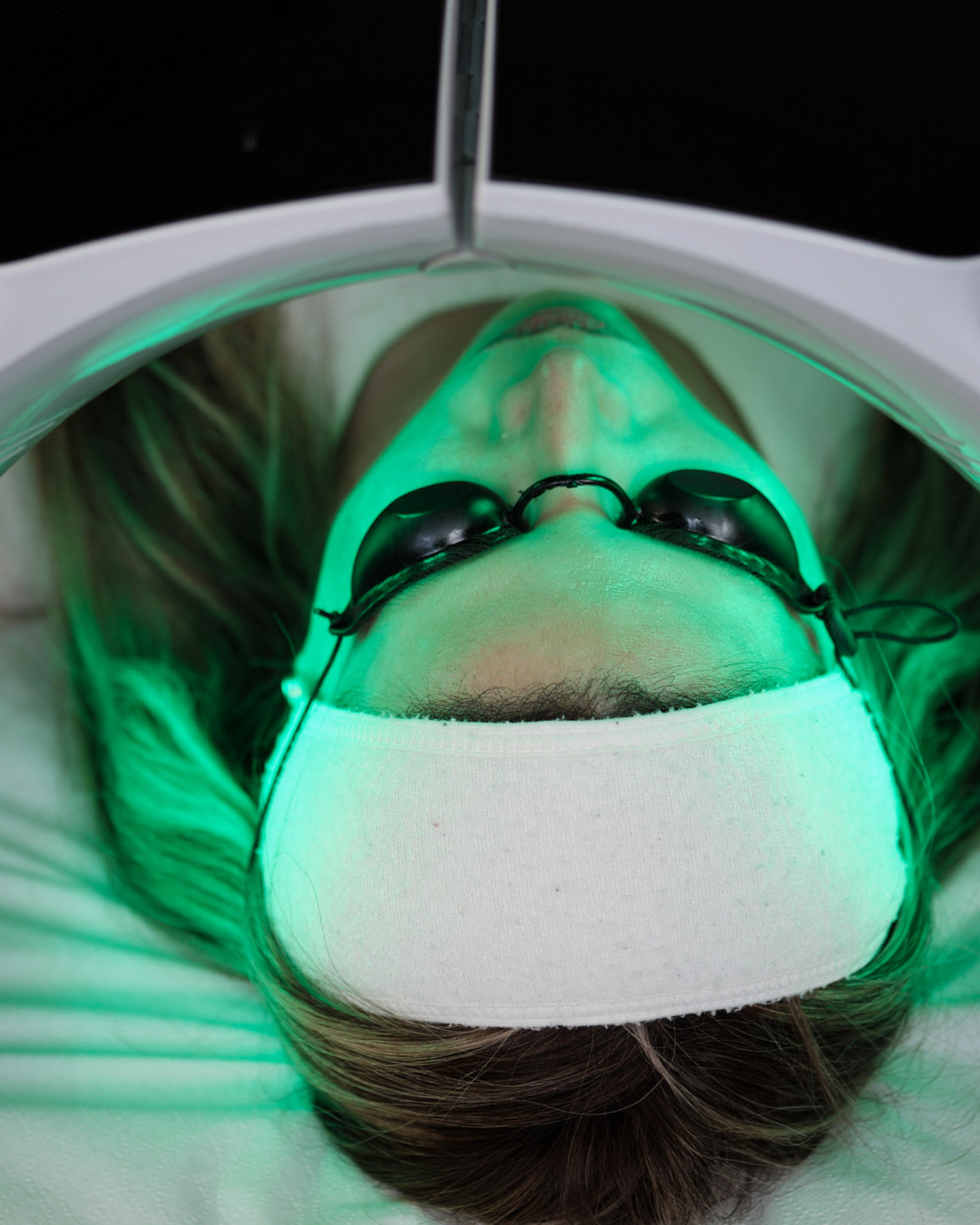 Tratamiento Despigmentante de Rostro