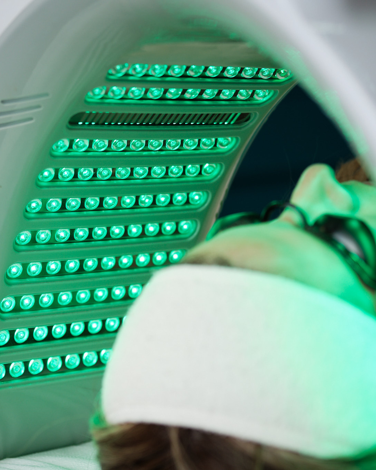 Tratamiento Despigmentante de Rostro