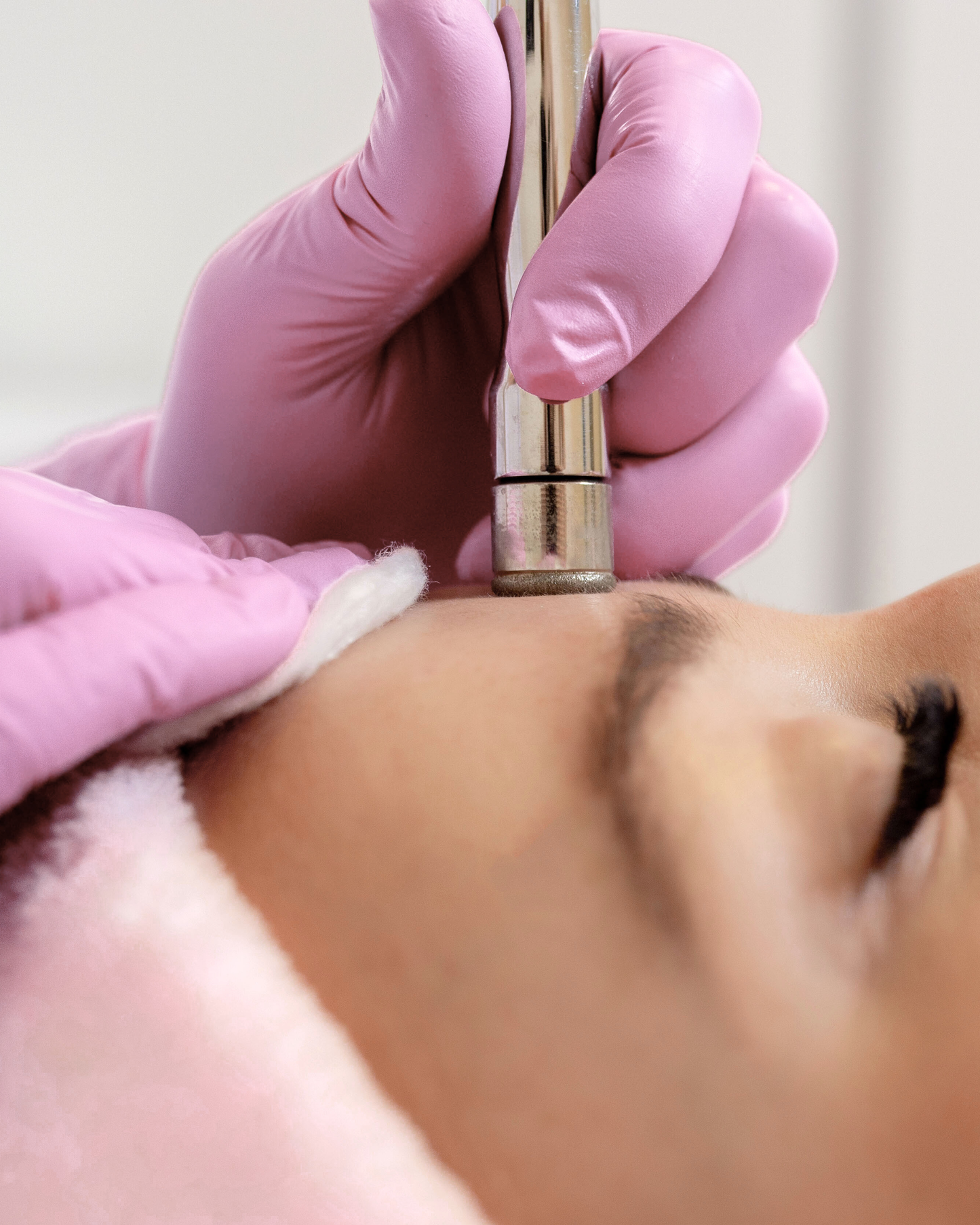 Tratamiento Despigmentante de Rostro