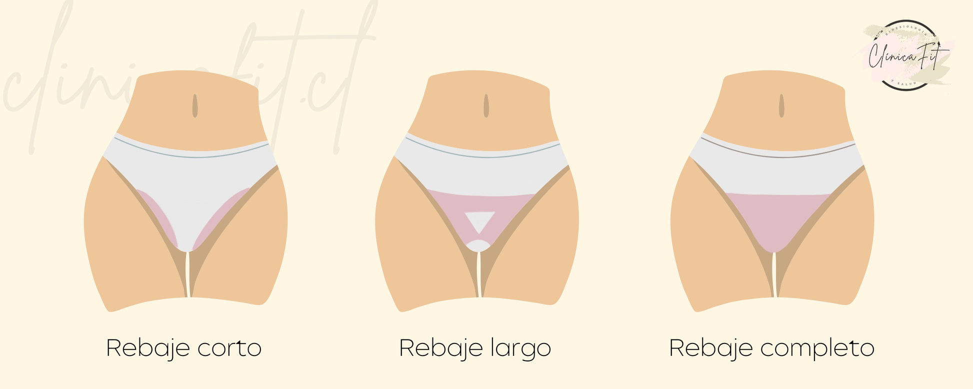 Depilación íntima Clínica Fit – Clinica Fit1